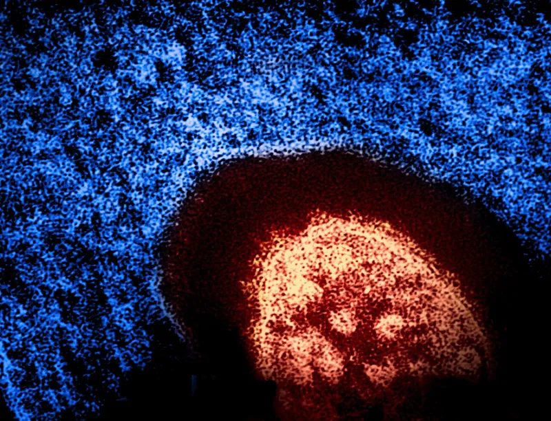 Colorized transmission electron micrograph of a measles virus particle, shown in red